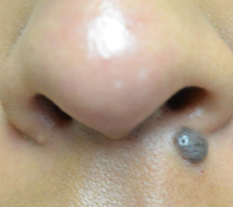 Before